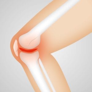 How to keep exercising even if you have bad, painful knees... How to keep exercising even if you have bad, painful knees...